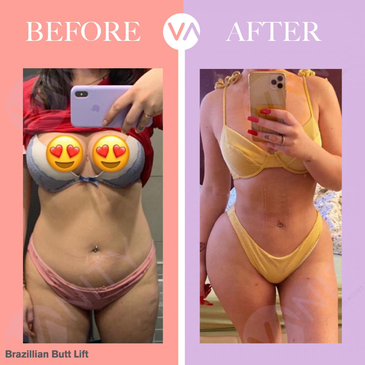 Slider image (3) Vanity Cosmetic Surgery Hospital